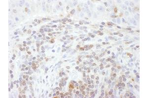 Immunohistochemistry (IHC) image for anti-Signal Transducer and Activator of Transcription 5A (STAT5A) (AA 744-794) antibody (ABIN7453648)