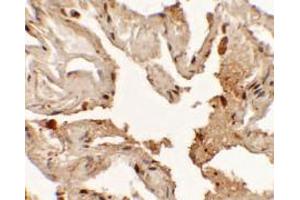 Immunohistochemistry of NKX2-1 in human lung tissue with NKX2-1 antibody at 2.