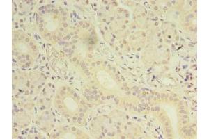 Immunohistochemistry of paraffin-embedded human pancreatic tissue using ABIN7165891 at dilution of 1:100 (OSR2 antibody  (AA 101-276))
