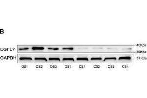 Compared with CS, EGFL7 is highly expressed in OS. (GAPDH antibody)