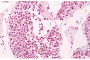 Human Testis: Formalin-Fixed, Paraffin-Embedded (FFPE) (Prostaglandin E Synthase antibody  (Cytoplasmic Domain))