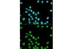 Immunofluorescence analysis of HeLa cells using Lamin A/C antibody. (Lamin A/C antibody)