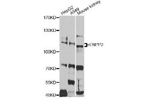 Western blot analysis of extracts of various cell lines, using ENPP2 antibody. (ENPP2 antibody)