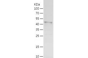 MEIS2 Protein (AA 1-381) (His tag)