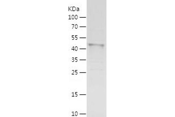 MEIS2 Protein (AA 1-381) (His tag)