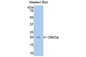 Western blot analysis of the recombinant protein. (PPIB antibody  (AA 47-216))