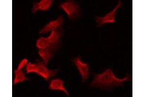 ABIN6275212 staining Hela by IF/ICC. (LDLRAD2 antibody  (Internal Region))