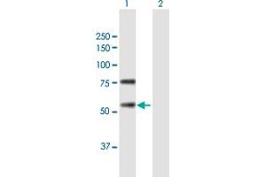 Western Blot analysis of REC8 expression in transfected 293T cell line by REC8 MaxPab polyclonal antibody. (REC8 antibody  (AA 1-547))