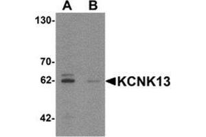 Western blot analysis of KCNK13 in rat brain tissue lysate with KCNK13 Antibody  at 0. (KCNK13 antibody  (Middle Region))