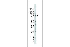 Western blot analysis of anti-PKCzeta Pab (ABIN391018 and ABIN2841189) in placenta lysate. (PKC zeta antibody  (N-Term))