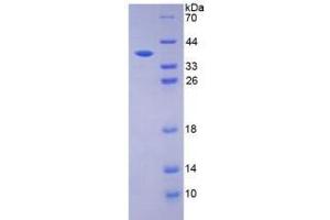 Image no. 1 for Histidine Decarboxylase (HDC) (AA 341-597) protein (His tag) (ABIN4990559)