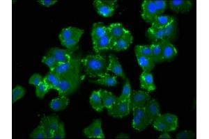 Immunofluorescence staining of HepG2 cells with ABIN7151078 at 1:100, counter-stained with DAPI. (NEDD4-2 antibody  (AA 289-494))
