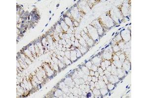 Immunohistochemistry of paraffin-embedded Human rectum using CHMP4B Polyclonal Antibody at dilution of 1:100 (40x lens). (CHMP4B antibody)