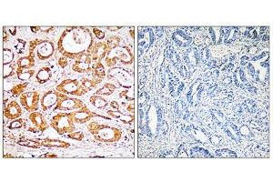 Immunohistochemistry analysis of paraffin-embedded human colon carcinoma tissue, using RPS19 antibody.