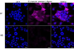 Immunocytochemical staining of HeLa cells using Glutamate-ammonia ligase antibody (ABIN7798741), 1:1,000), Top panel: wild-type (WT), Bottom panal: Glutamate-ammonia ligase shRNA knockdown (KD). (Recombinant GLUL antibody)