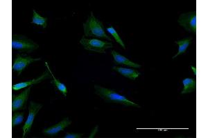 Immunofluorescence of purified MaxPab antibody to CALCB on HeLa cell. (CALCB antibody  (AA 1-127))