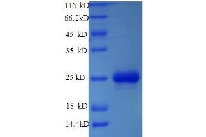 SDS-PAGE (SDS) image for MATRX (AA 1-202), (full length) protein (His tag) (ABIN5714052)