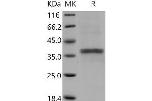 ACP5 Protein (His tag)