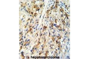 Immunohistochemistry (IHC) image for anti-Cat Eye Syndrome Chromosome Region, Candidate 5 (CECR5) antibody (ABIN3003803) (CECR5 antibody)