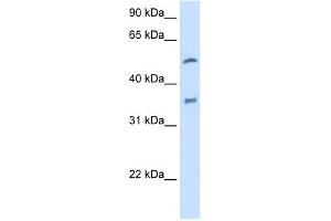 WB Suggested Anti-CYP2D6 Antibody Titration:  2.