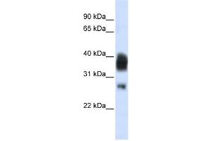RNASEH1 antibody used at 1 ug/ml to detect target protein. (Ribonuclease H1 antibody  (Middle Region))
