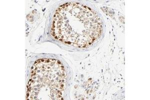 Immunohistochemical staining of human testis with ASB9 polyclonal antibody  shows strong nuclear and moderate cytoplasmic positivity in cells in seminiferus ducts at 1:200-1:500 dilution.