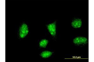 Immunofluorescence of monoclonal antibody to HAND2 on HeLa cell. (HAND2 antibody  (AA 135-216))