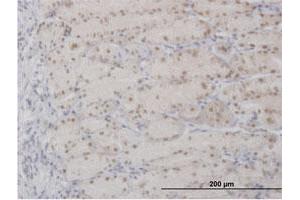 Immunohistochemistry (Formalin-fixed Paraffin-embedded Sections) (IHC (fp)) image for anti-Apurinic/Apyrimidinic Endonuclease 1 (APEX1) (AA 1-318) antibody (ABIN513392)