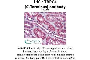 Image no. 1 for anti-Transient Receptor Potential Cation Channel, Subfamily C, Member 4 (TRPC4) (C-Term), (Internal Region) antibody (ABIN1740389) (TRPC4 antibody  (C-Term, Internal Region))