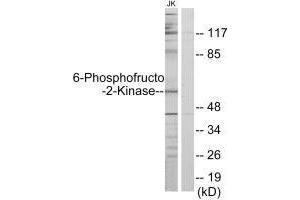 Western blot analysis of extracts from Jurkat cells, using PFKFB2 antibody. (PFKFB2 antibody  (N-Term))