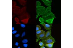 ABIN6263917 and ABIN6272379 staining Hela cells(30 min of UV treatment) by IF/ICC. (OTUB2 antibody  (Internal Region))