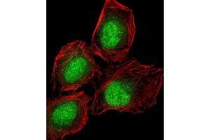 Immunofluorescence (IF) image for anti-delta Like Protein 3 (DLL3) (AA 519-548), (C-Term) antibody (ABIN653276)