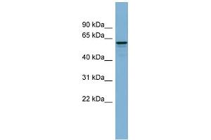 WB Suggested Anti-DCTN4 Antibody Titration: 0. (Dynactin 4 antibody  (N-Term))