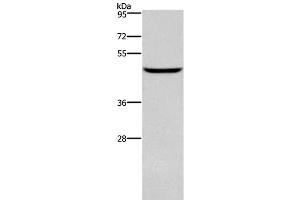 Western Blot analysis of Human testis tissue using DMRT3 Polyclonal Antibody at dilution of 1:550 (DMRT3 antibody)