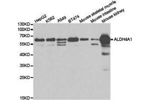 Western Blotting (WB) image for anti-Aldehyde Dehydrogenase 4 Family, Member A1 (ALDH4A1) antibody (ABIN1870929)
