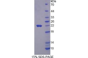 Image no. 1 for Cancer/testis Antigen 1B (CTAG1B) (AA 1-180) protein (His tag) (ABIN4990794) (CTAG1B Protein (AA 1-180) (His tag))