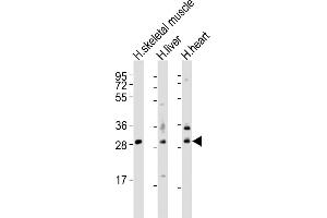 All lanes : Anti-Z1 Antibody (N-Term) at 1:2000 dilution Lane 1: human skeletal muscle lysates Lane 2: human liver lysates Lane 3: human heart lysates Lysates/proteins at 20 μg per lane. (AMZ1 antibody  (AA 4-39))