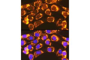 Immunofluorescence analysis of NIH-3T3 cells using  Rabbit pAb (ABIN7265423) at dilution of 1:100 (40x lens). (ACSL1 antibody  (AA 46-275))