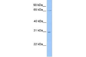 WB Suggested Anti-NR1D2 Antibody Titration:  0. (NR1D2 antibody  (N-Term))