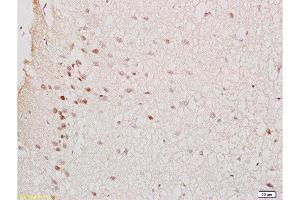 Formalin-fixed and rat brain tissue labeled with Anti-GTPBP10 Polyclonal Antibody , Unconjugated at 1:200 followed by conjugation to the secondary antibody and DAB staining