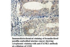Image no. 1 for anti-Fibronectin Type III and Ankyrin Repeat Domains 1 (FANK1) antibody (ABIN1576454) (FANK1 antibody)