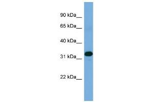 WB Suggested Anti-ZNF511 Antibody Titration: 0.
