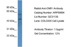 Western Blotting (WB) image for anti-Cannabinoid Receptor 1 (CNR1) (N-Term) antibody (ABIN2788297) (CNR1 antibody  (N-Term))