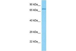 Host:  Rabbit  Target Name:  GP1BA  Sample Tissue:  Human 786-0 Whole Cell  Antibody Dilution:  1ug/ml (CD42b antibody  (C-Term))