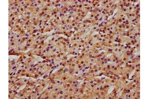 IHC image of ABIN7151301 diluted at 1:600 and staining in paraffin-embedded human adrenal gland tissue performed on a Leica BondTM system. (Zinc Finger Protein 650 (ZNF650) (AA 960-1113) antibody)