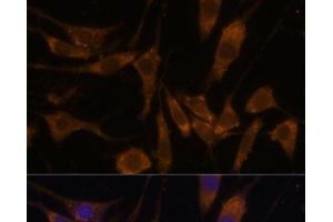 Immunofluorescence analysis of L929 cells using STAR Polyclonal Antibody at dilution of 1:100 (40x lens). (STAR antibody)