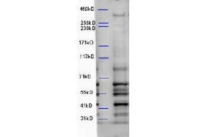 ABIN2560761 (5µg/ml) staining of Mouse Brain lysate (35µg protein in RIPA buffer). (WDFY3 antibody  (Internal Region))
