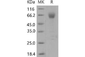 Western Blotting (WB) image for Intercellular Adhesion Molecule 2 (ICAM2) (Active) protein (Fc Tag) (ABIN7196242) (ICAM2 Protein (Fc Tag))