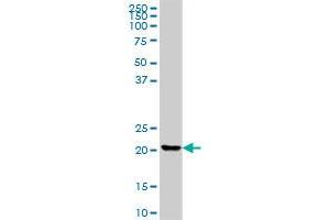 CLTB MaxPab polyclonal antibody. (CLTB antibody  (AA 1-211))