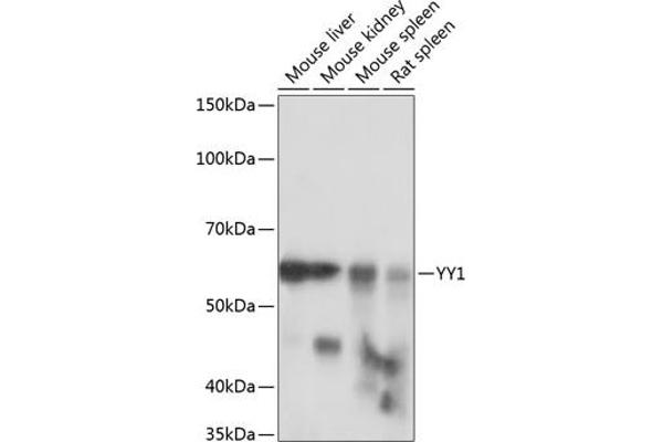 YY1 antibody